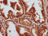MCTP2 Antibody - Immunohistochemistry Dilution at 1:300 and staining in paraffin-embedded human prostate tissue performed on a Leica BondTM system. After dewaxing and hydration, antigen retrieval was mediated by high pressure in a citrate buffer (pH 6.0). Section was blocked with 10% normal Goat serum 30min at RT. Then primary antibody (1% BSA) was incubated at 4°C overnight. The primary is detected by a biotinylated Secondary antibody and visualized using an HRP conjugated SP system.