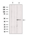 MCU / CCDC109A Antibody - Western blot analysis of extracts of mouse brain tissue using CCDC109A antibody. Lane 1 was treated with the blocking peptide.