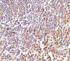 MD-1 / LY86 Antibody - Immunohistochemistry of MD-1 in human spleen tissue with MD-1 antibody at 2 ug/ml.