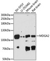MDGA2 Antibody - Western blot analysis of extracts of various cell lines, using MDGA2 antibody at 1:1000 dilution. The secondary antibody used was an HRP Goat Anti-Rabbit IgG (H+L) at 1:10000 dilution. Lysates were loaded 25ug per lane and 3% nonfat dry milk in TBST was used for blocking. An ECL Kit was used for detection and the exposure time was 90s.