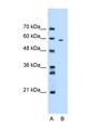 MDM4 / MDMX Antibody - MDM4 / MDMX antibody AVARP06007_T100-NP_002384-MDM4 (Mdm4, transformed 3T3 cell double minute 4, p53 binding protein (mouse)) Antibody Western blot of HepG2 Cell lysate. Antibody concentration 1 ug/ml.  This image was taken for the unconjugated form of this product. Other forms have not been tested.