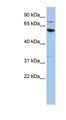 ME1 / Malate Dehydrogenase Antibody - ME1 antibody Western blot of HepG2 cell lysate. This image was taken for the unconjugated form of this product. Other forms have not been tested.
