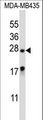 MEA1 Antibody - MEA1 Antibody (N-term ) western blot of MDA-MB435 cell line lysates (35 ug/lane). The MEA1 antibody detected the MEA1 protein (arrow).