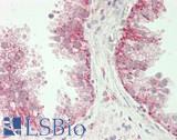 MECOM / EVI1 Antibody - Human Prostate: Formalin-Fixed, Paraffin-Embedded (FFPE)