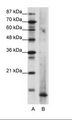 MECOM / EVI1 Antibody - A: Marker, B: Rap Cell Lysate.  This image was taken for the unconjugated form of this product. Other forms have not been tested.
