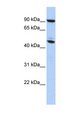 MECP2 Antibody - MECP2 antibody Western blot of HepG2 cell lysate. This image was taken for the unconjugated form of this product. Other forms have not been tested.