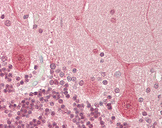 MECP2 Antibody - Human Brain, Cerebellum: Formalin-Fixed, Paraffin-Embedded (FFPE).  This image was taken for the unconjugated form of this product. Other forms have not been tested.