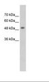 MECP2 Antibody - Jurkat Cell Lysate.  This image was taken for the unconjugated form of this product. Other forms have not been tested.