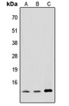 MED11 Antibody - Western blot analysis of MED11 expression in HeLa (A); NIH3T3 (B); PC12 (C) whole cell lysates.
