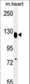 MED14 Antibody - MED14 Antibody western blot of mouse heart tissue lysates (35 ug/lane). The MED14 antibody detected the MED14 protein (arrow).
