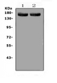 MED14 Antibody - Western blot analysis of MED14 using anti-MED14 antibody. Electrophoresis was performed on a 5-20% SDS-PAGE gel at 70V (Stacking gel) / 90V (Resolving gel) for 2-3 hours. The sample well of each lane was loaded with 50ug of sample under reducing conditions. Lane 1: rat liver tissue lysates,Lane 2: mouse liver tissue lysates. After Electrophoresis, proteins were transferred to a Nitrocellulose membrane at 150mA for 50-90 minutes. Blocked the membrane with 5% Non-fat Milk/ TBS for 1.5 hour at RT. The membrane was incubated with rabbit anti-MED14 antigen affinity purified polyclonal antibody at 0.5 ug/mL overnight at 4?, then washed with TBS-0.1% Tween 3 times with 5 minutes each and probed with a goat anti-rabbit IgG-HRP secondary antibody at a dilution of 1:10000 for 1.5 hour at RT. The signal is developed using an Enhanced Chemiluminescent detection (ECL) kit with Tanon 5200 system. A specific band was detected for MED14 at approximately 160KD. The expected band size for MED14 is at 160KD.