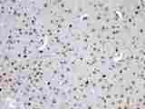 MED15 / ARC105 Antibody - Immunohistochemistry - Anti-MED15/Pcqap Picoband Antibody