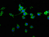 MED15 / ARC105 Antibody - Immunofluorescence staining of SH-SY5Y cells at a dilution of 1:100, counter-stained with DAPI. The cells were fixed in 4% formaldehyde, permeabilized using 0.2% Triton X-100 and blocked in 10% normal Goat Serum. The cells were then incubated with the antibody overnight at 4 °C.The secondary antibody was Alexa Fluor 488-congugated AffiniPure Goat Anti-Rabbit IgG (H+L) .