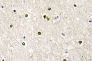 MED17 / TRAP80 Antibody - IHC of CRSP77 (V171) pAb in paraffin-embedded human brain tissue.