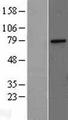 MED17 / TRAP80 Protein - Western validation with an anti-DDK antibody * L: Control HEK293 lysate R: Over-expression lysate