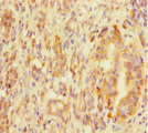 MED20 Antibody - Immunohistochemistry of paraffin-embedded human pancreatic tissue at dilution 1:100