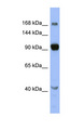 MED23 / SUR2 Antibody - MED23 / DRIP130 antibody Western blot of OVCAR-3 cell lysate. This image was taken for the unconjugated form of this product. Other forms have not been tested.