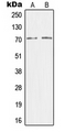 MED26 / CRSP7 Antibody - Western blot analysis of CRSP7 expression in HEK293T (A); HeLa (B) whole cell lysates.