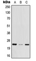 MED29 / IXL Antibody - Western blot analysis of MED29 expression in HEK293T (A); mouse brain (B); rat lung (C) whole cell lysates.