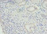 MED30 Antibody - Immunohistochemistry of paraffin-embedded human pancreatic tissue using antibody at dilution of 1:100.