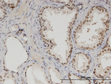 MED6 Antibody - Immunoperoxidase of monoclonal antibody to MED6 on formalin-fixed paraffin-embedded human prostate. [antibody concentration 3 ug/ml]
