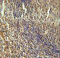MEF2A / MEF2 Antibody - MEF2A Antibody immunohistochemistry of formalin-fixed and paraffin-embedded human tonsil tissue followed by peroxidase-conjugated secondary antibody and DAB staining.