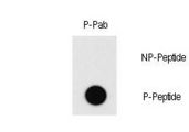 MEF2C Antibody - Dot blot of Phospho-MEF2C-T20 antibody on nitrocellulose membrane. 50ng of Phospho-peptide or Non Phospho-peptide per dot were adsorbed. Antibody working concentration was 0.5ug per ml. P-antibody: phospho-antibody; P-Peptide: phospho-peptide; NP-Peptide: non-phospho-peptide.