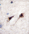 MEF2C Antibody - Formalin-fixed and paraffin-embedded human brain tissue reacted with MEF2C Antibody (S387) , which was peroxidase-conjugated to the secondary antibody, followed by DAB staining. This data demonstrates the use of this antibody for immunohistochemistry; clinical relevance has not been evaluated.