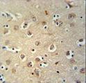 MEIS2 Antibody - MEIS2 Antibody (Center D269) immunohistochemistry of formalin-fixed and paraffin-embedded human brain tissue followed by peroxidase-conjugated secondary antibody and DAB staining. This data demonstrates the use of the MEIS2 Antibody (Center D269) for immunohistochemistry.
