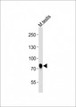 MELK Antibody - Anti-Melk Antibody at 1:1000 dilution + mouse testis lysates Lysates/proteins at 20 ug per lane. Secondary Goat Anti-Rabbit IgG, (H+L), Peroxidase conjugated at 1/10000 dilution Predicted band size : 73 kDa Blocking/Dilution buffer: 5% NFDM/TBST.