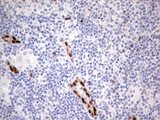 MEOX1 Antibody - IHC of paraffin-embedded Human lymph node tissue using anti-MEOX1 Mouse monoclonal antibody. (heat-induced epitope retrieval by 1 mM EDTA in 10mM Tris, pH8.5, 120°C for 3min).