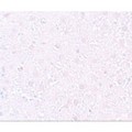 MEOX1 Antibody - Immunohistochemistry of MOX1 in rat liver tissue with MOX1 antibody at 10 µg/mL.