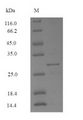 Mer a 1 Protein - (Tris-Glycine gel) Discontinuous SDS-PAGE (reduced) with 5% enrichment gel and 15% separation gel.