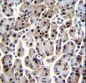 MESP1 Antibody - MESP1 Antibody immunohistochemistry of formalin-fixed and paraffin-embedded human pancreas tissue followed by peroxidase-conjugated secondary antibody and DAB staining.