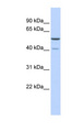 METTL15 / METT5D1 Antibody - METTL15 / METT5D1 antibody Western blot of Fetal Brain lysate. This image was taken for the unconjugated form of this product. Other forms have not been tested.