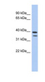 METTL19 Antibody - METTL19 / C4orf23 antibody Western blot of Fetal Spleen lysate. This image was taken for the unconjugated form of this product. Other forms have not been tested.