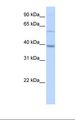 METTL2B Antibody - HepG2 cell lysate. Antibody concentration: 0.5 ug/ml. Gel concentration: 12%.  This image was taken for the unconjugated form of this product. Other forms have not been tested.