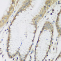 METTL7A Antibody - Immunohistochemistry of paraffin-embedded human stomach tissue.