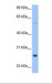 METTL7B Antibody - Jurkat cell lysate. Antibody concentration: 1.0 ug/ml. Gel concentration: 12%.  This image was taken for the unconjugated form of this product. Other forms have not been tested.