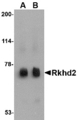 MEX3C Antibody - Western blot of Rkhd2 in rat heart tissue lysate with Rkhd2 antibody at (A) 0.5 ug/ml and (B) 1 ug/ml