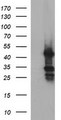MFAP3 Antibody - HEK293T cells were transfected with the pCMV6-ENTRY control (Left lane) or pCMV6-ENTRY MFAP3 (Right lane) cDNA for 48 hrs and lysed. Equivalent amounts of cell lysates (5 ug per lane) were separated by SDS-PAGE and immunoblotted with anti-MFAP3.