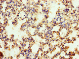 MFSD11 / ET Antibody - Immunohistochemistry of paraffin-embedded human lung tissue using MFSD11 Antibody at dilution of 1:100