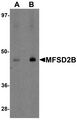 MFSD2B Antibody - Western blot analysis of MFSD2B in rat lung tissue lysate with MFSD2B antibody at (A) 1 and (B) 2 ug/ml.