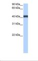 MFSD3 Antibody - MCF7 cell lysate. Antibody concentration: 0.5 ug/ml. Gel concentration: 12%.  This image was taken for the unconjugated form of this product. Other forms have not been tested.
