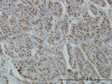 MGAT4A Antibody - Immunoperoxidase of monoclonal antibody to MGAT4A on formalin-fixed paraffin-embedded human pancreas. [antibody concentration 0.2 ug/ml]