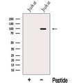 MGAT5B Antibody - Western blot analysis of extracts of Jurkat cells using MGAT5B antibody. The lane on the left was treated with blocking peptide.