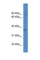 MGC11296 / BRMS1L Antibody - BRMS1L antibody Western blot of HeLa Cell lysate. Antibody concentration 1 ug/ml.  This image was taken for the unconjugated form of this product. Other forms have not been tested.