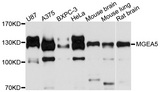 MGEA5 Antibody - Western blot analysis of extracts of various cell lines.