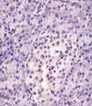 MGEA5 Antibody - MGEA5 Antibody (N-Term) staining MGEA5 in human pancreas tissue sections by Immunohistochemistry (IHC-P - paraformaldehyde-fixed, paraffin-embedded sections). Tissue was fixed with formaldehyde and blocked with 3% BSA for 0. 5 hour at room temperature; antigen retrieval was by heat mediation with a citrate buffer (pH6). Samples were incubated with primary antibody (1/25) for 1 hours at 37°C. A undiluted biotinylated goat polyvalent antibody was used as the secondary antibody.