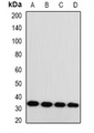 MGLL / Monoacylglycerol Lipase Antibody - Western blot analysis of Monoglyceride Lipase expression in HT29 (A); SKOV3 (B); mouse heart (C); mouse brain (D) whole cell lysates.